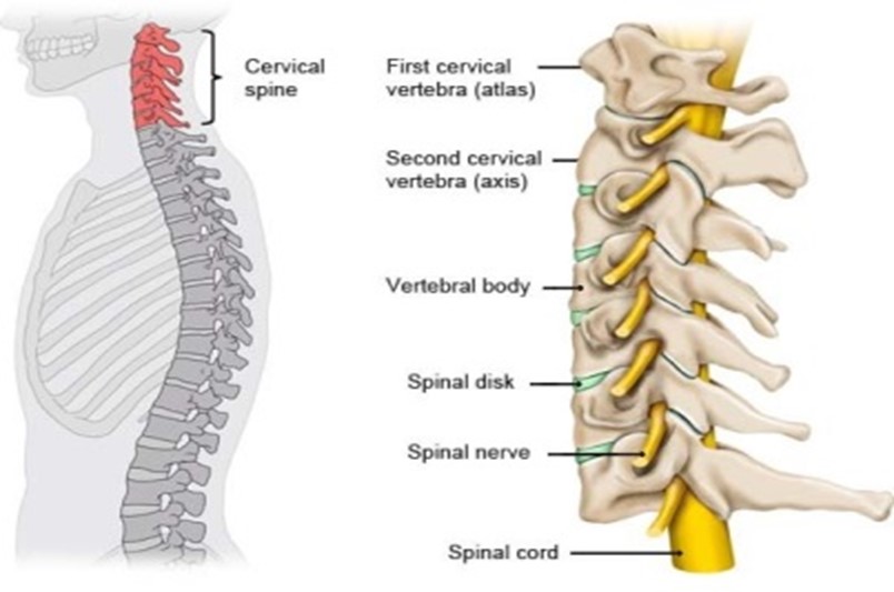 NECK PAIN